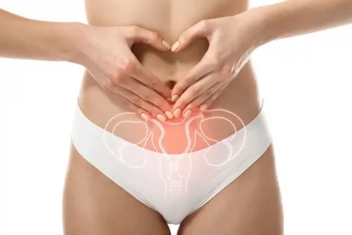 Endometrioza_zdjecie